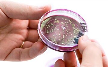 Bacteriile din secreția prostatei